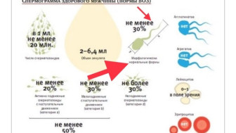 Спермограмма: когда и зачем сдавать этот анализ?